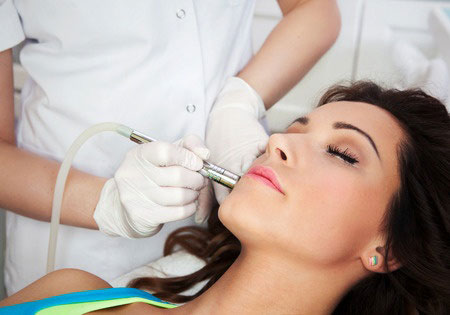 microdermabrasion facial treatments at Suzanne's beauty salon in Coventry