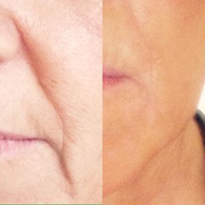 Dermalogica Overnight Retinol Repair, Suzanne's Hair & Beauty Salon, Coventry