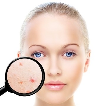 Four Steps To Clear Skin
