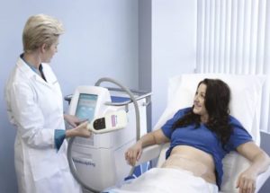 Fat Freezing For Weight Loss At Suzannes Hair Beauty Salon in Coventry
