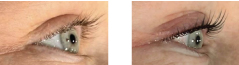 EyeTreatments