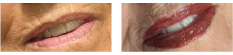 Lip Blush & Liner (Semi Permanent Make-Up