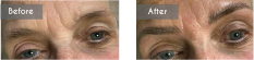 Micro Blading